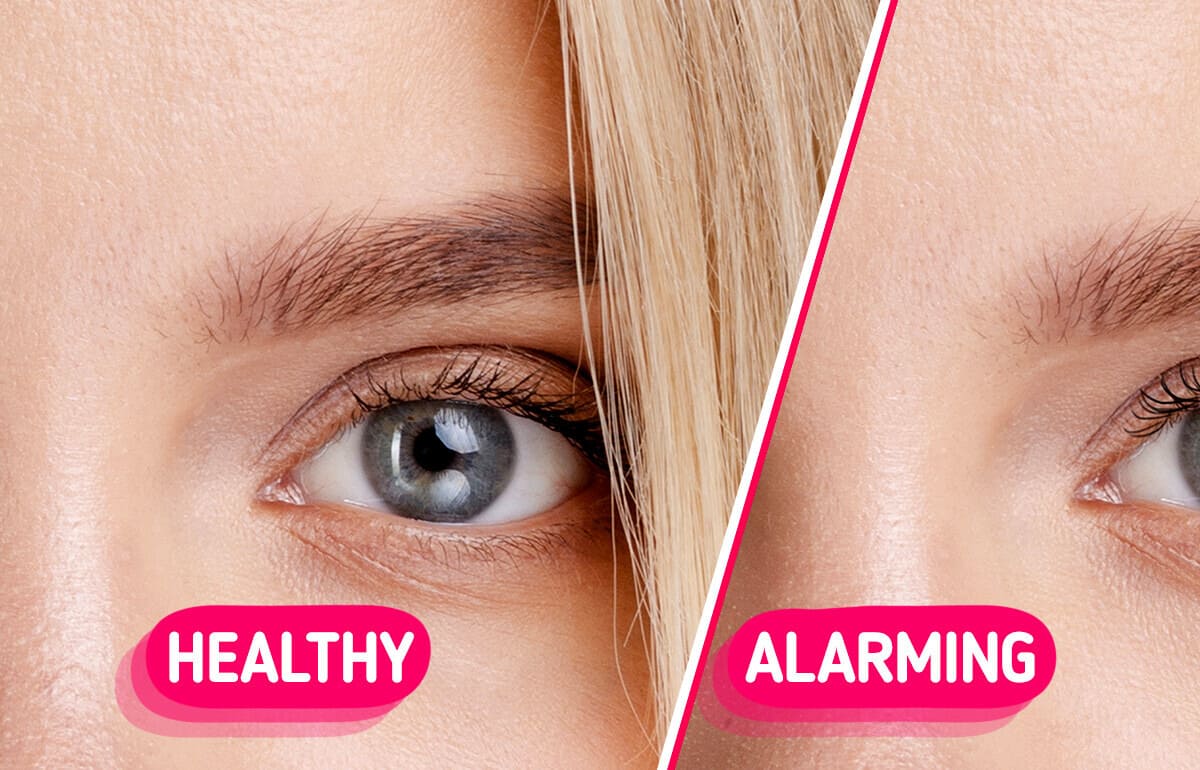 5 Subtle Clues That Could Reveal Hidden Health Problems