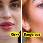 10 Beauty Procedures That May Be More Harmful Than Useful