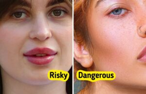 10 Beauty Procedures That May Be More Harmful Than Useful