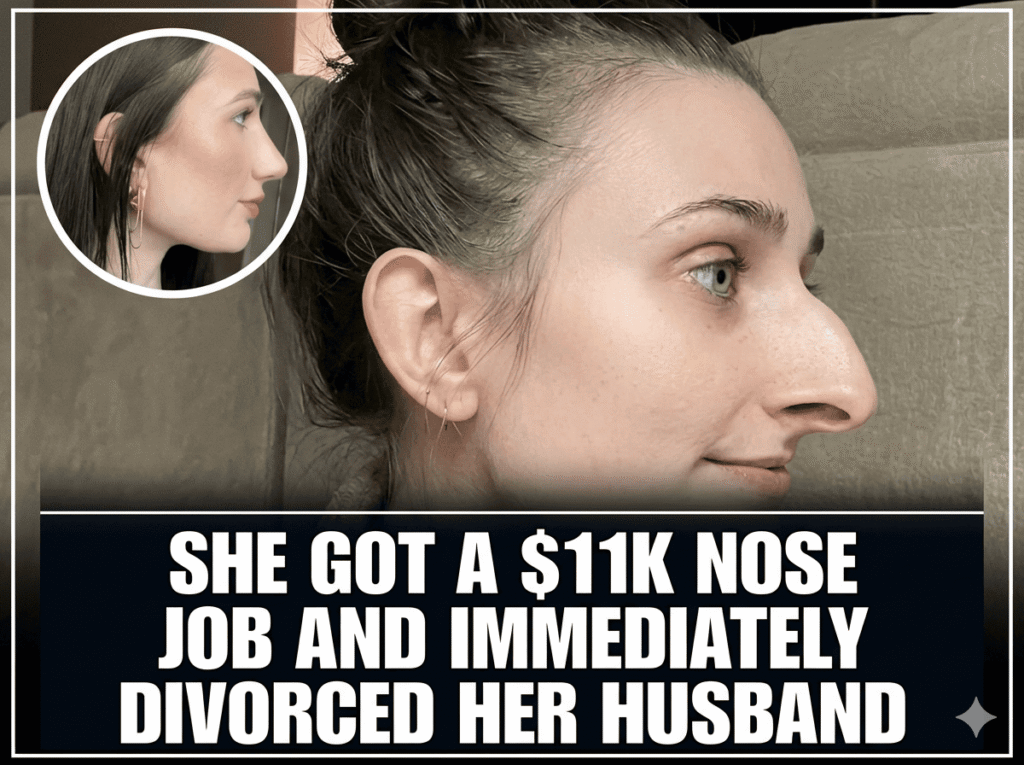 She got a $11k Nose job and immediately Divorced her Husband